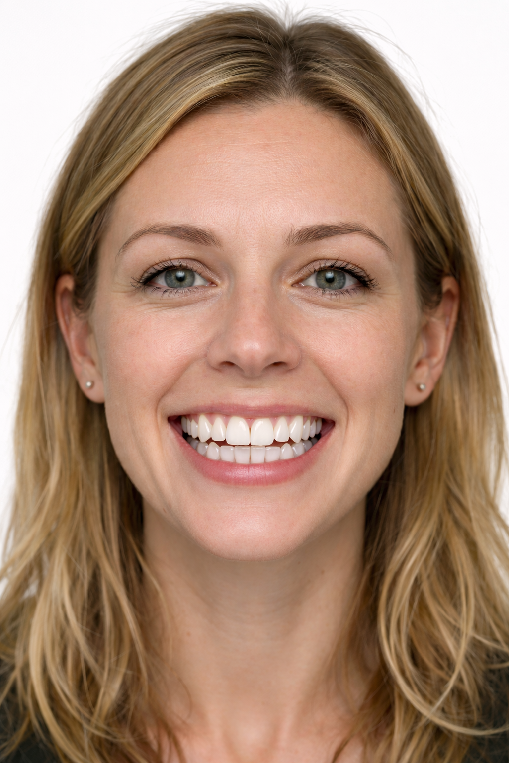 After dental treatment