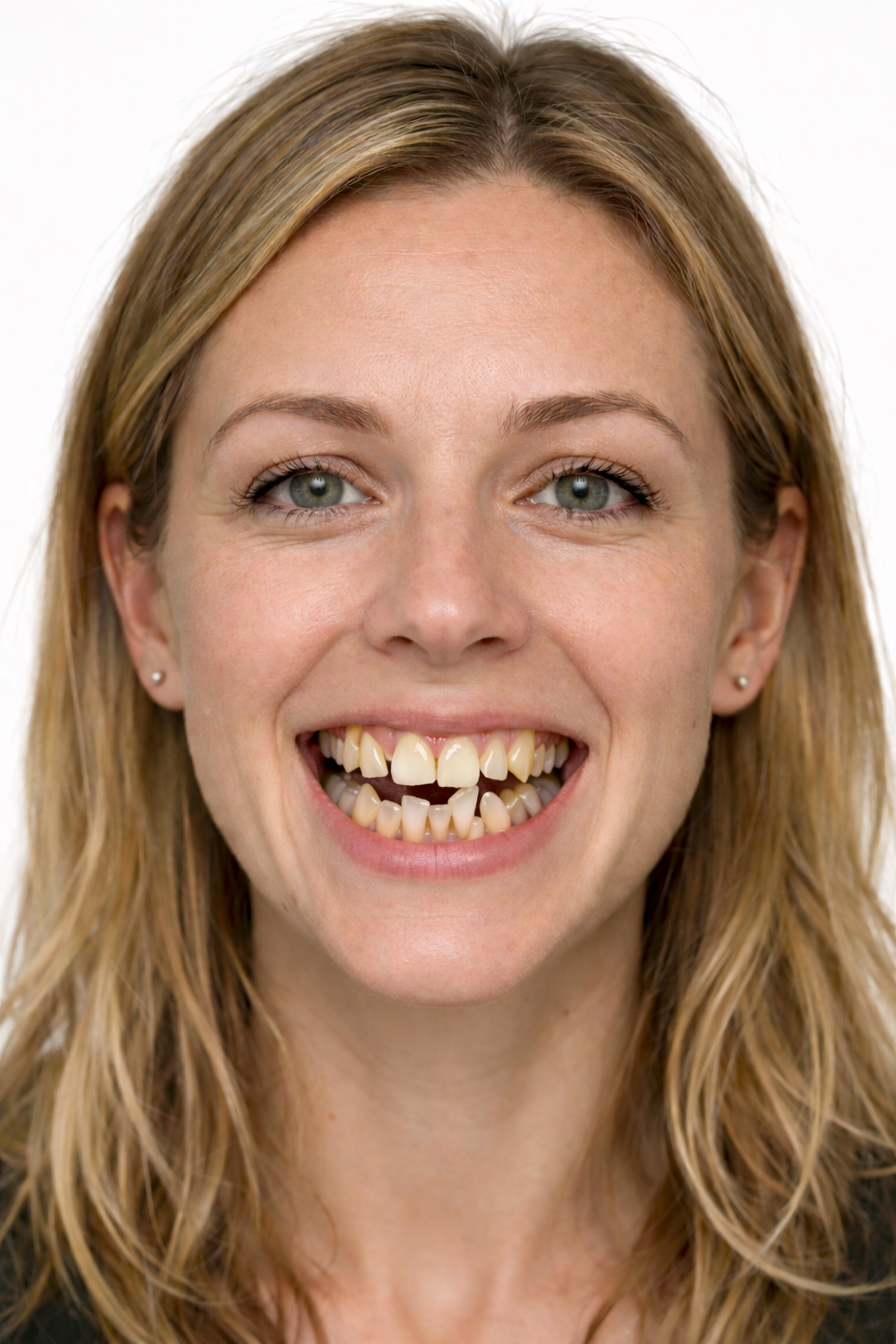 Before dental treatment